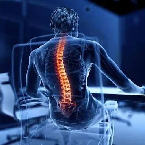 Spinal Stiffness