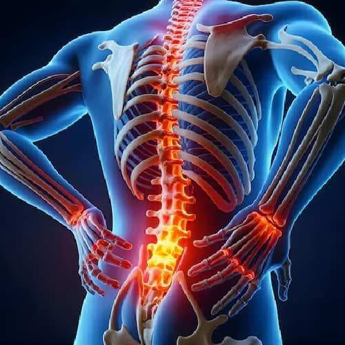 Back pain