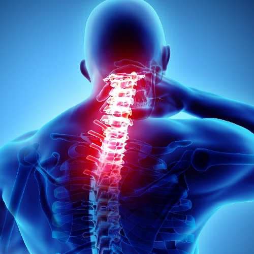 Neck Pain (Cervical Pain)